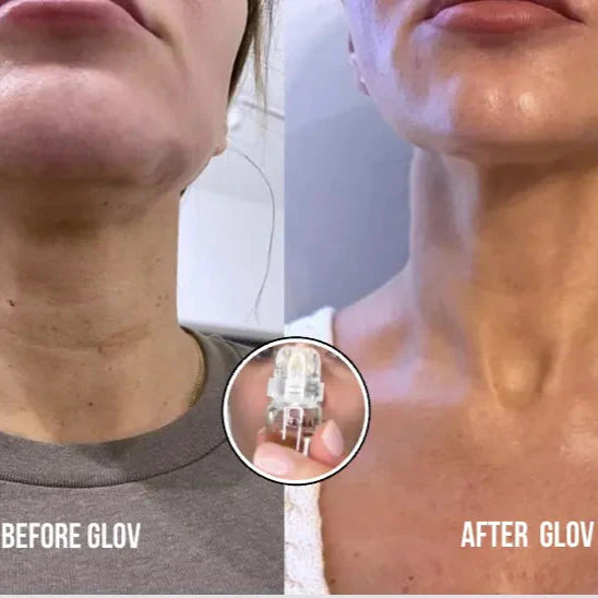 Système de perfusion Glov Micro